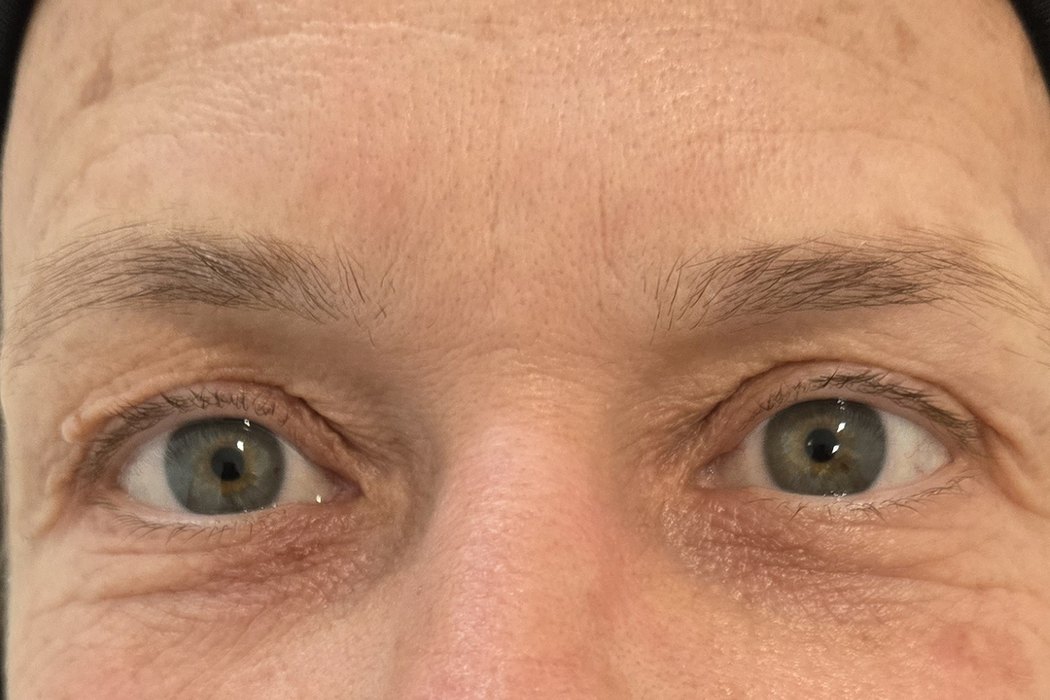 Client brows before microblading