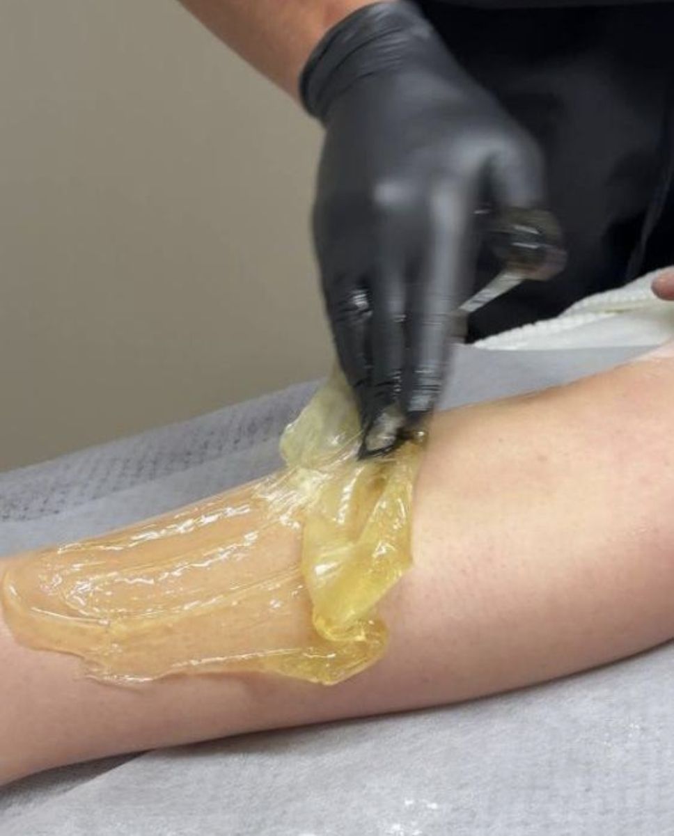 Sugaring paste applied to a leg